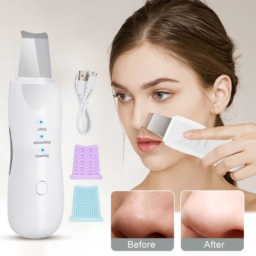 Vibration Face Skin Scrubber Blackhead Remover Facial Cleaner