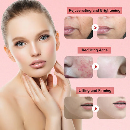 Face Lifting Device EMS Microcurrent Skin LED Facial Neck Massager